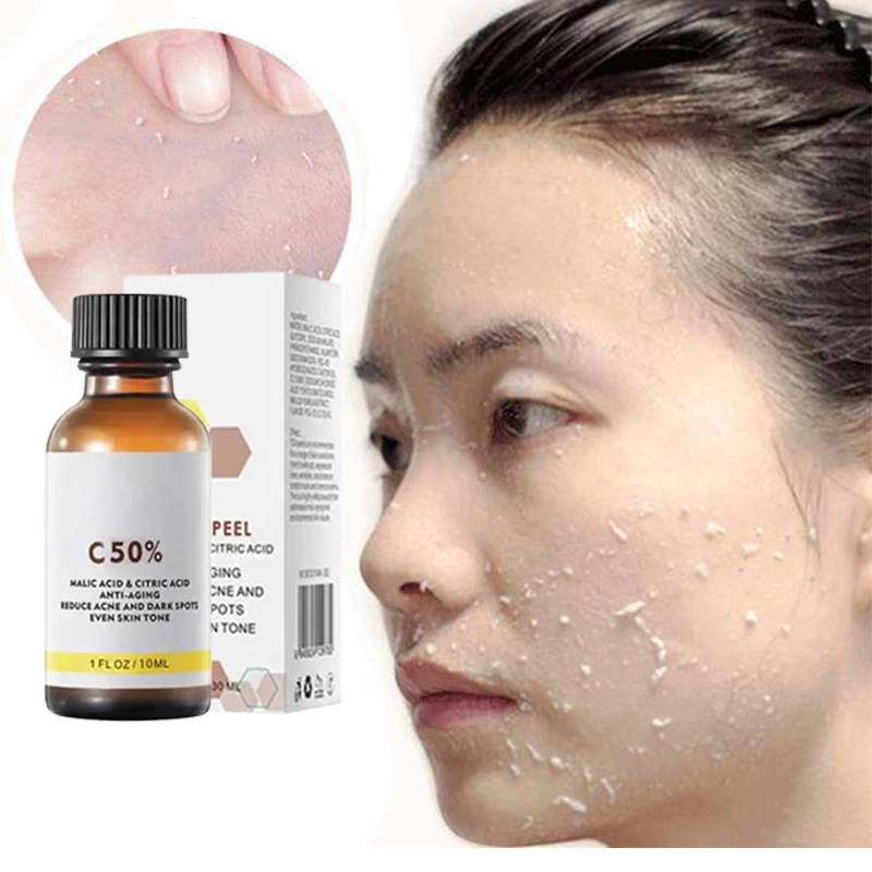 Azelaic Acid Serum - 3nd Peeling Oil for Dark Skin