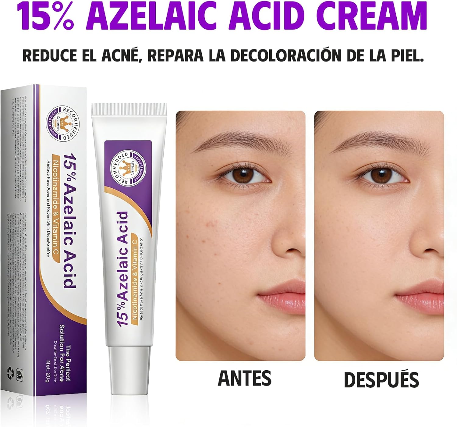 15% Azelaic Acid Facial Serum, - Azelaic Acid Serum 评论和价格